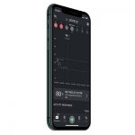 Continuous Glucose Monitor